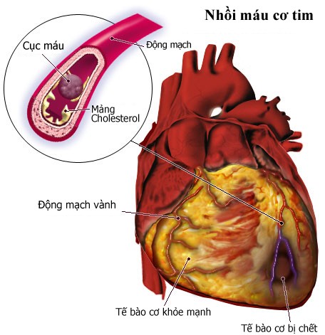 Các bẹnh dẽ dãn dén tai bién tuong tụ nhạc sĩ An Thuyen-Hinh-3